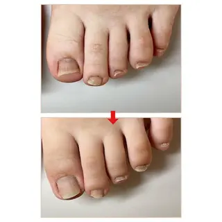 ネイル ネイルサロン アリュームのネイルデザイン