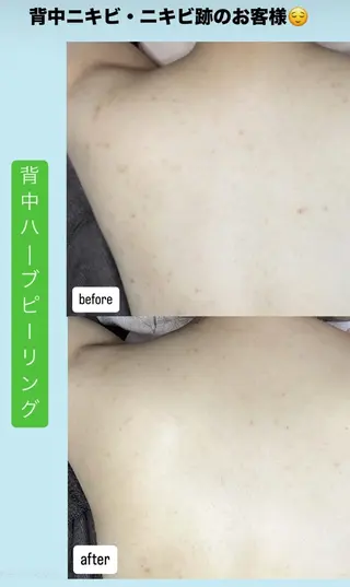 ベラージュ【美背中・ 美尻・フェイシャル】のエステ・リラクイメージ