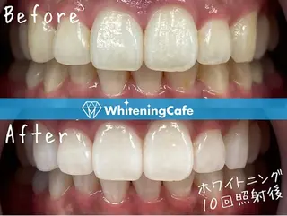 ホワイトニングカフェ 荻窪店のその他イメージ