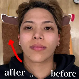 医療提携Ruby小顔 ハーブピーリング加藤のエステ・リラクイメージ