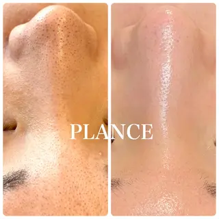 フェイシャル専門 肌質改善/プランスのエステ・リラクイメージ