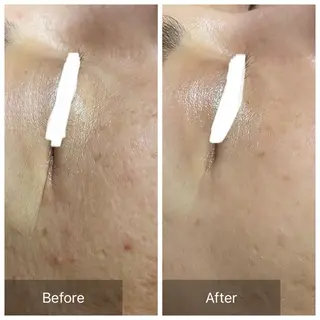 バフトアップ/ハーブ Nornのエステ・リラクイメージ