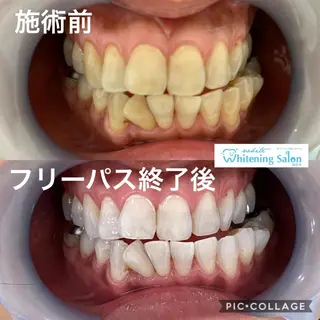 アイラッシュ ホワイトニング四日市のマツエク・マツパデザイン