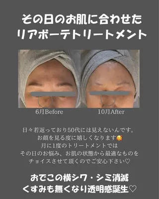 BLOSSOM 菊地のエステ・リラクイメージ