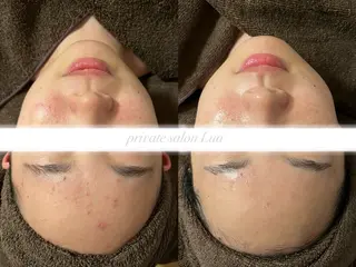 salon Lua🌛のエステ・リラクイメージ