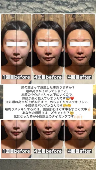 💎後悔させない小顔 矯正💎イトヤマ🌱のエステ・リラクイメージ