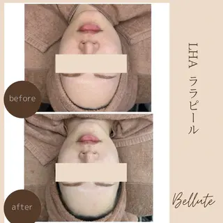 ピーリング専門店 Belluteのエステ・リラクイメージ