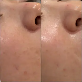 顔脱毛×エステサロン BLOOMi.の眉毛・アイブロウイメージ