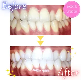 メンズ nanami -ホワイトニングのその他イメージ