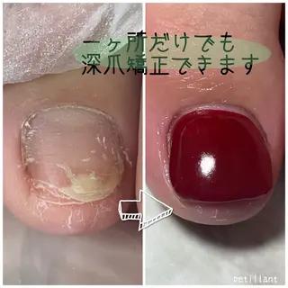 ネイル nail salon petillantのネイルデザイン