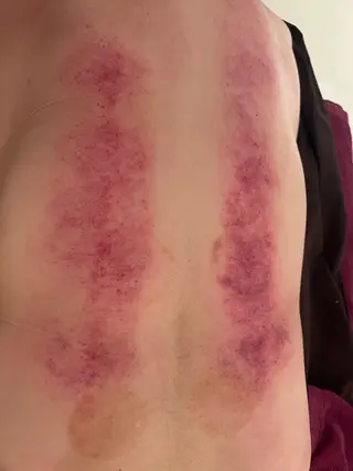 鍼処　木蓮所属・小顔美肌クリエーター 鍼処木蓮のエステ・リラクイメージ