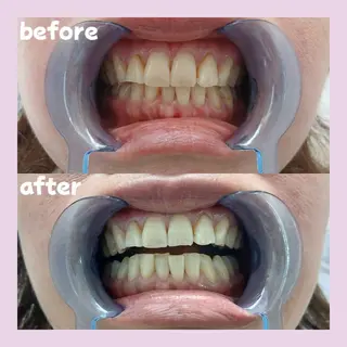 セルフホワイトニングサロンPalet【パレ】所属・太田 菜那のその他イメージ