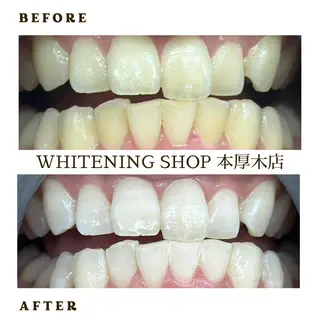 メンズ ホワイトニング ショップ本厚木のその他イメージ