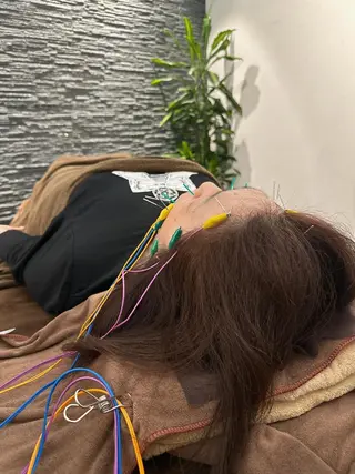 小顔矯/美容鍼/鍼灸 BeauJuのその他イメージ