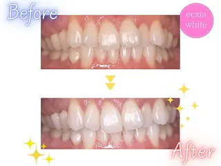 セルフホワイトニング エクシア新宿御苑店のその他イメージ