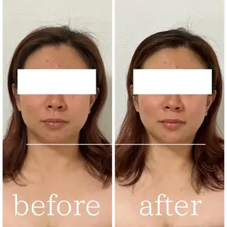 毛穴肌質ケアサロン Yourmeユアミーのエステ・リラクイメージ