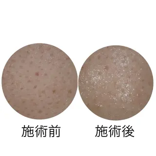 メナード丸の内ヒルズ 柳田りさのエステ・リラクイメージ