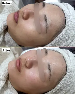 |ピーリング・毛穴| soina神楽坂のエステ・リラクイメージ