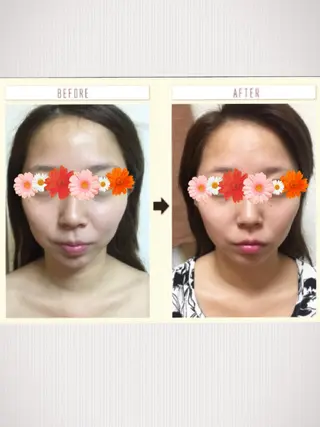 美容鍼灸師 齋藤 麗子のエステ・リラクイメージ