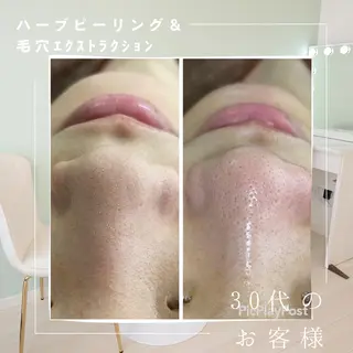 Rifuro毛穴ケア &よもぎ蒸しサロンのエステ・リラクイメージ