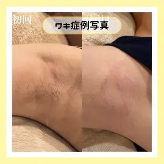 金山/脱毛/美肌 ULULUのエステ・リラクイメージ