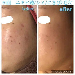 ショート カラー パーマ ヘアアレンジ メンズ キッズ ネイル マツエク・マツパ EnsorClair 代表　野口真央のエステ・リラクイメージ