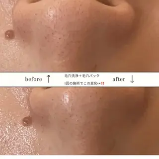 skinLabo所属・saya Mのエステ・リラクイメージ