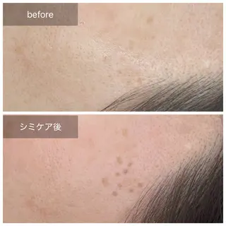 トータルしみケア専門 NICA(ニカ)の眉毛・アイブロウイメージ