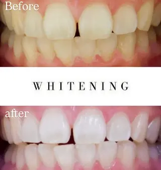 Luv the TERRACEの眉毛・アイブロウイメージ