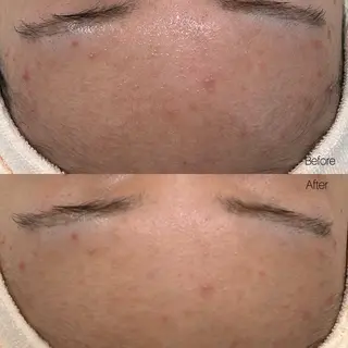 etre - 韓国肌管理 -のエステ・リラクイメージ