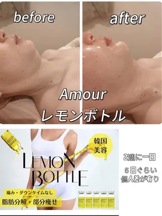 痩身・小顔・脱毛・ オイル&Amourのその他イメージ
