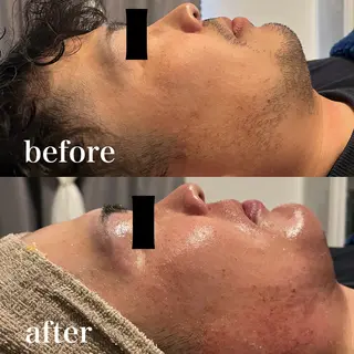 メンズ wax脱毛専門店 ハイラントのエステ・リラクイメージ