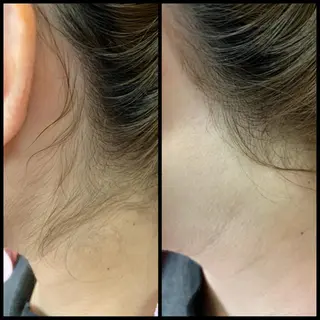 レディースシェービングサロンbijou所属・シェービングサロン bijouの眉毛・アイブロウイメージ