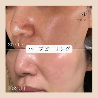 ピーリング専門店 Belluteのエステ・リラクイメージ