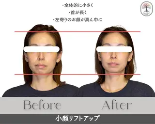 ヘッドスパ・小顔矯正 十色　横浜のエステ・リラクイメージ