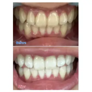 M渋谷 ホワイトニングのエステ・リラクイメージ