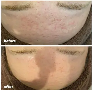 本気の肌質改善スキン デトックス🌿のエステ・リラクイメージ