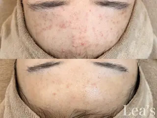 Lea's所属・【Lea's 】 hazukiのエステ・リラクイメージ