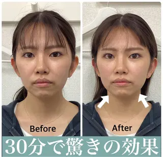 ハリサロンドオフ 美容鍼灸×小顔整体のエステ・リラクイメージ