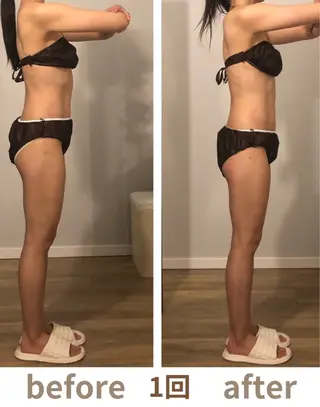 小顔.足痩せ整体 痩身天六Sunaoのその他イメージ