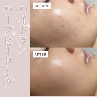 プライベートサロン Belle（ベル）のエステ・リラクイメージ