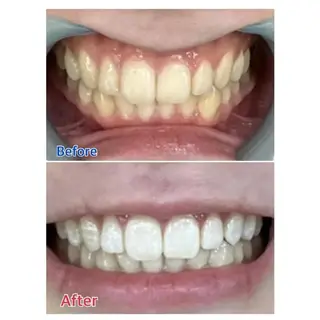 M渋谷 ホワイトニングのエステ・リラクイメージ