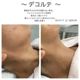ビューティー ミロワールのエステ・リラクイメージ