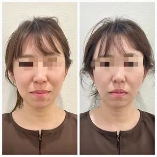 鍼灸 ハリカラのエステ・リラクイメージ