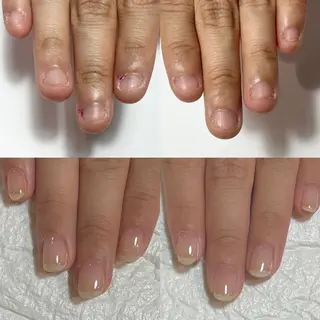 ネイル 自爪育成・巻き爪 補正講師　津蔵のネイルデザイン