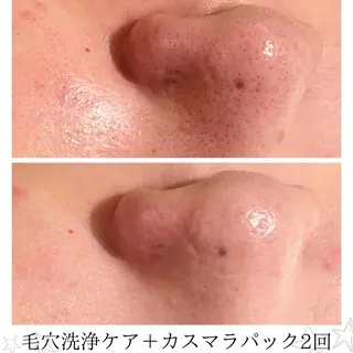 CHERIE Hisadaのエステ・リラクイメージ