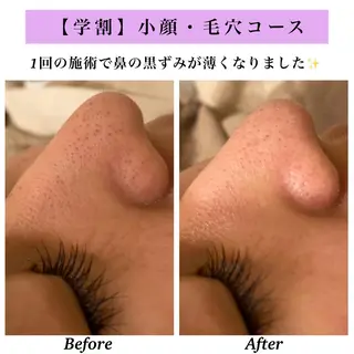 Bellesthe (ベルエステ)のエステ・リラクイメージ