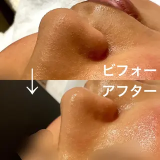 ビューティーサロン ソナタのエステ・リラクイメージ