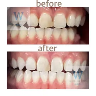 ホワイトニング ショップ船橋2号店のエステ・リラクイメージ