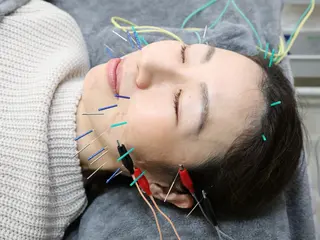 美容鍼脱毛salon リノン吹田駅前店のエステ・リラクイメージ